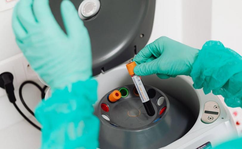 епідемічна ситуація 