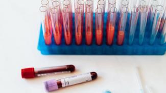 епідемічна ситуація 